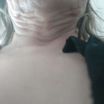 Uzm. Dr. Sevil Gizlenti Tarafından Yapılan Gıdı Operasyonu Sonucu Gıdım Eskisinden Daha Kötü Oldu!