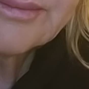 Uzm. Dr. Sevil Gizlenti Tarafından Yapılan Gıdı Operasyonu Sonucu Gıdım Eskisinden Daha Kötü Oldu!