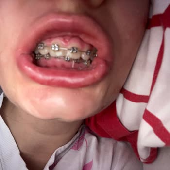 Dt. Rabia Kuşçuoğlu Mağduriyeti