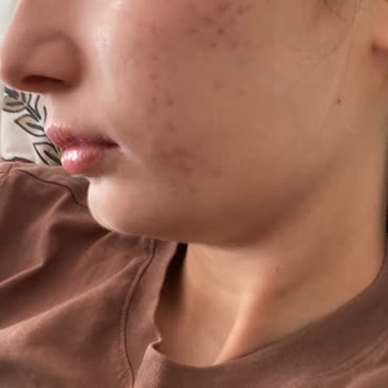 Dt. Rabia Kuşçuoğlu Mağduriyeti