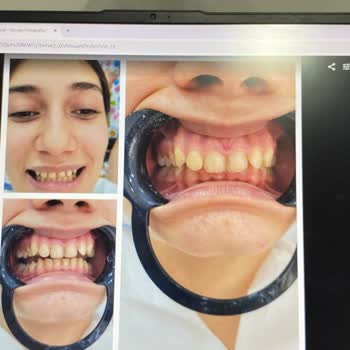 Dt. Rabia Kuşçuoğlu Mağduriyeti