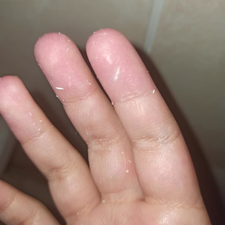 Güneş Kremi Cildimde Topaklanma Ve Soyulma Yaptı