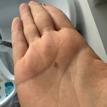 Antebella Ürününde Yabancı Madde Şoku: Çocuğumun Sağlığı Tehlikeye Girdi