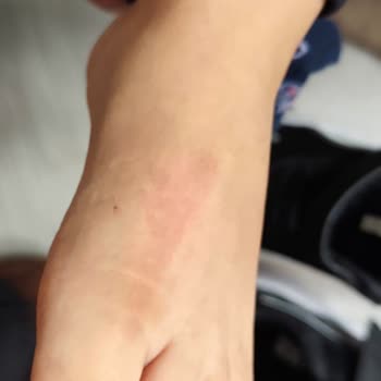 Deichmann Kusurlu Ayakkabı İadesinde Mağaza Prosedürü ve Sorumsuzluk Mağduriyeti