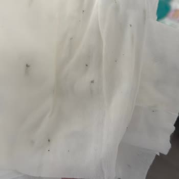 Amazon'dan Aldığım Islak Mendiller Küflü Ve Kullanılamaz Geldi