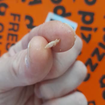 Dodo Pizza Siparişimde Tehlikeli Yabancı Cisim Çıktı