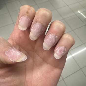 Derya Güzellik Salonu | Ankara Oje Çıkarırken Tırnaklarımı Mahvetti