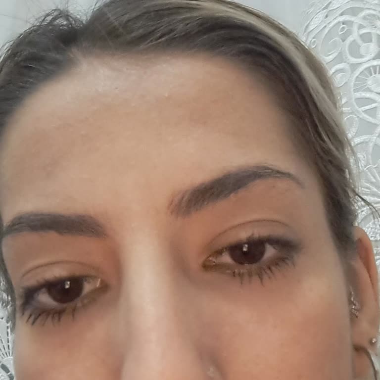 Solis Güzellik Merkezi Lifting Uygulaması Sonrası Kirpiklerim Zarar Gördü