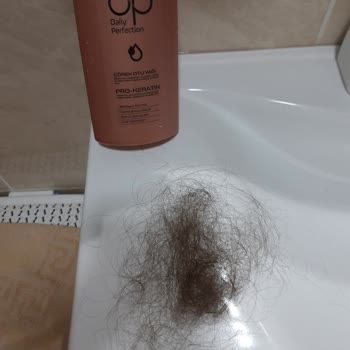 DP Şampuan Saç Dökülmesine Ve Psikolojik Etkiye Yol Açtı