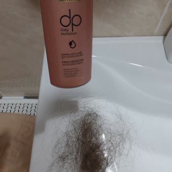 DP Şampuan Saç Dökülmesine Ve Psikolojik Etkiye Yol Açtı