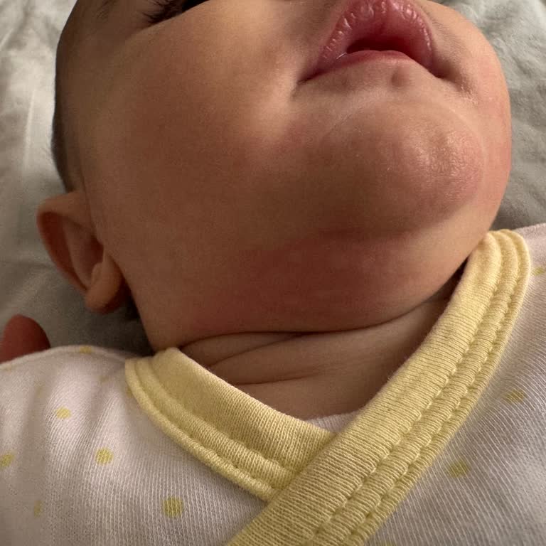 Hipp Mama Bebeğimde Alerjik Reaksiyona Sebep Oldu!