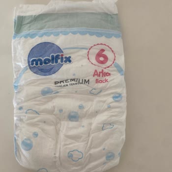 Molfix Bebek Bezlerinde Sızıntı Sorunu Ve Yetersiz Koruma