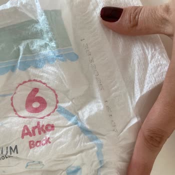 Molfix Bebek Bezlerinde Sızıntı Sorunu Ve Yetersiz Koruma