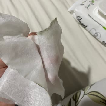 Küflü Ve Kötü Kokulu Islak Mendil Bebeğimin Sağlığını Riske Attı