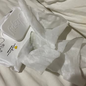 Küflü Ve Kötü Kokulu Islak Mendil Bebeğimin Sağlığını Riske Attı