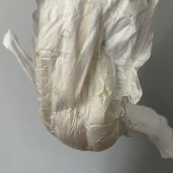 Sleepy Bio Natural Bebek Bezinde Renk Göstergesi Sorunu