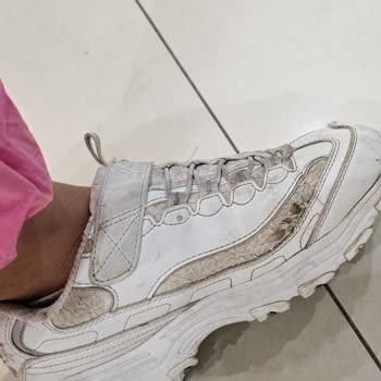 Skechers Üç Ayda Yırtılan Ayakkabı Ve İlgisiz Firma Yaklaşımı