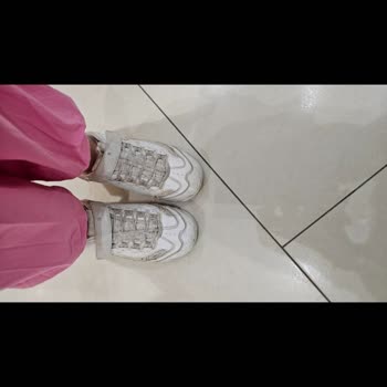 Skechers Üç Ayda Yırtılan Ayakkabı Ve İlgisiz Firma Yaklaşımı