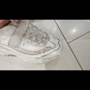 Skechers Üç Ayda Yırtılan Ayakkabı Ve İlgisiz Firma Yaklaşımı