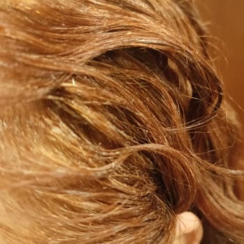 Keratin Saç Köpüğünde İçerik Değişikliği Sonrası Saçta Sertlik Ve Dökülme Sorunu