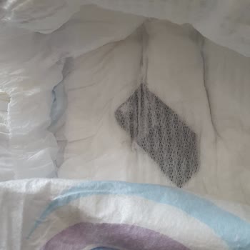 Bebek Bezinden Sert Parça Çıkması Ve Hijyen Endişesi