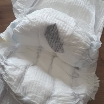 Bebek Bezinden Sert Parça Çıkması Ve Hijyen Endişesi