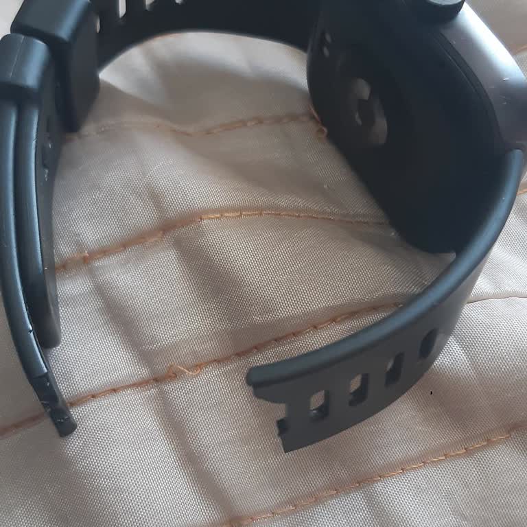 Redmi Watch 4 Saatimin Kordonu Bir Yıl Dolmadan Yırtıldı, Garanti Kapsamında Değişim Talebim Var