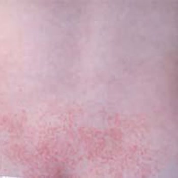 Sleepy Bezde Kötü Koku Ve Bebeğimde Alerji Sorunu Yaşadım