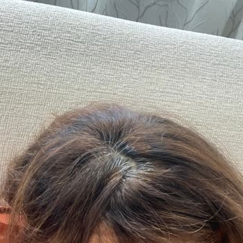 Saç Boyasında Yapılan Hatalar Ve Çalışan İlgisizliğiyle Yaşadığım Mağduriyet