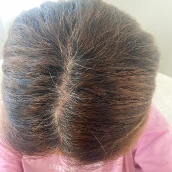 Saç Boyasında Yapılan Hatalar Ve Çalışan İlgisizliğiyle Yaşadığım Mağduriyet