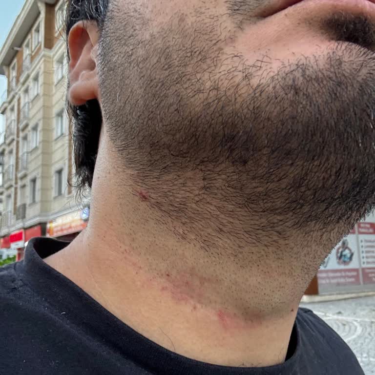 Maskumen Hair Lounge Beylikdüzü Az Kalsın Boğazımı Kesecekti