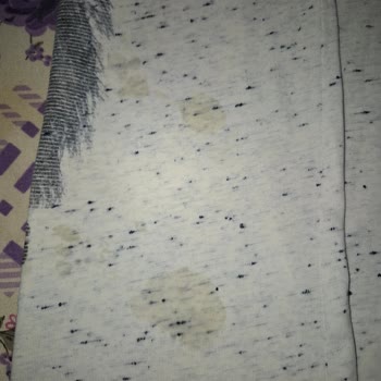 Arızalı Ütü Ve Yetersiz Servis Desteği Mağduriyetimi Artırıyor