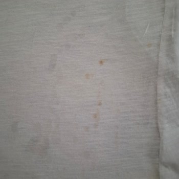 Arızalı Ütü Ve Yetersiz Servis Desteği Mağduriyetimi Artırıyor