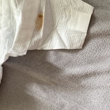 Molfix'ten Güven Sarsan Lekeli Bebek Bezi Şoku