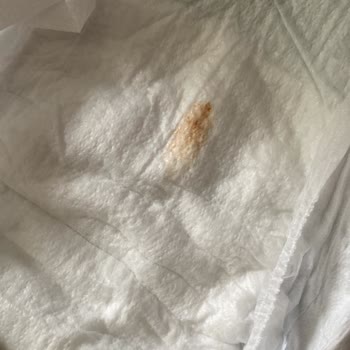 Molfix'ten Güven Sarsan Lekeli Bebek Bezi Şoku