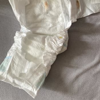 Molfix'ten Güven Sarsan Lekeli Bebek Bezi Şoku