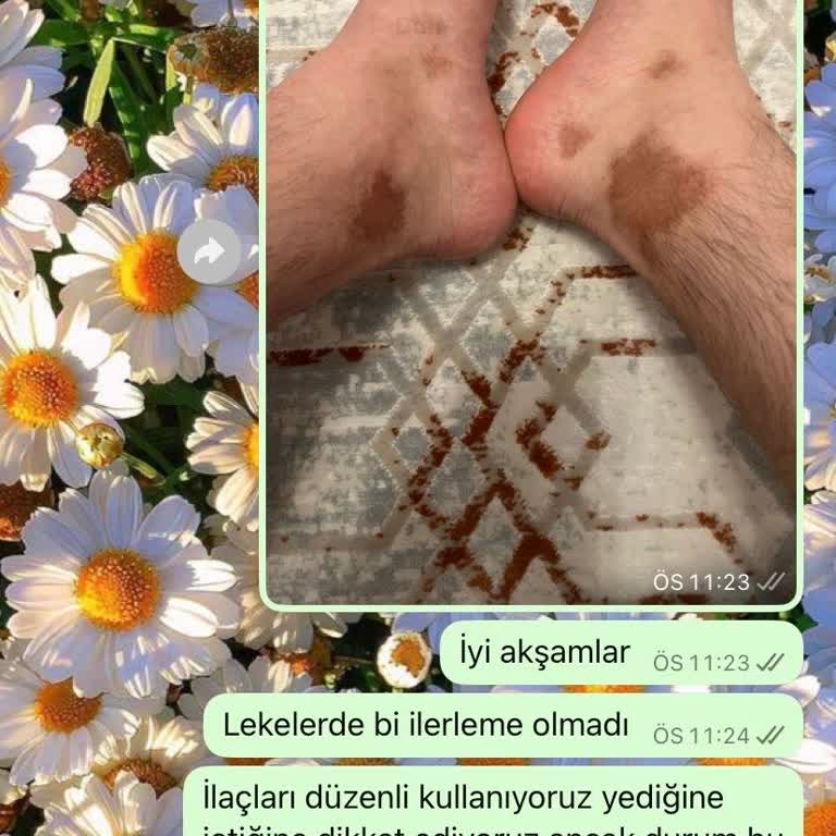 Sağlık Hizmeti Yerine Ticari Yaklaşım Ve İlgisizlik