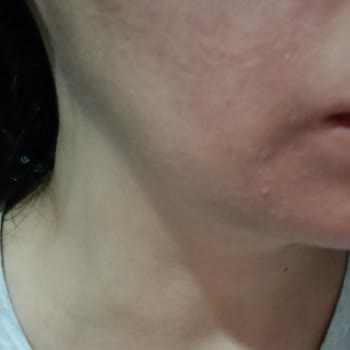 Bee Beauty Makyaj Temizleme Suyu Cildimde Yanma Ve Kaşıntı Yaptı