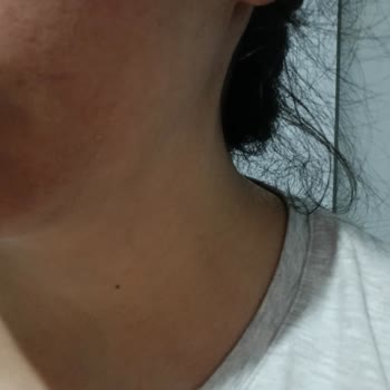 Bee Beauty Makyaj Temizleme Suyu Cildimde Yanma Ve Kaşıntı Yaptı