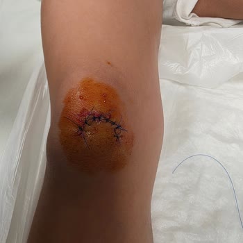 Luxera İnşaat Fayansların Hepsinin Kırık ve Cam Gibi Keskin Olması