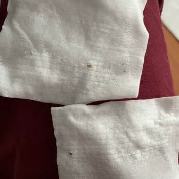 Bebek Pamuğunda Böcek Ve Küf Şoku Yaşadım