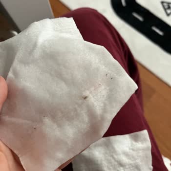Bebek Pamuğunda Böcek Ve Küf Şoku Yaşadım