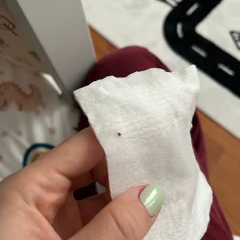 Bebek Pamuğunda Böcek Ve Küf Şoku Yaşadım