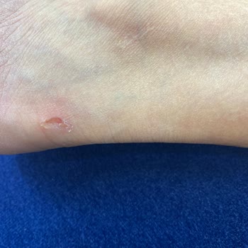 Calvin Klein Ayakkabı Her Giyişte Ayağımı Yaraladı