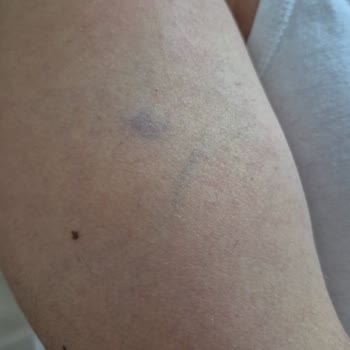 Batıkent Acar Koleji'den Şikayetçiyim