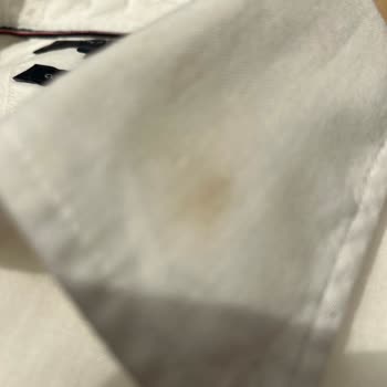 Satın Alınan Lekeli Ürün İçin Değişim Talebine Mağazadan Olumsuz Yanıt