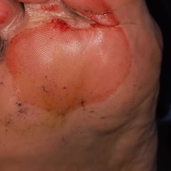 Boyner'den Aldığım Kusurlu Ayakkabı Ve 5 Aydır Cevapsız Kalan Şikayetim