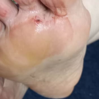 Boyner'den Aldığım Kusurlu Ayakkabı Ve 5 Aydır Cevapsız Kalan Şikayetim