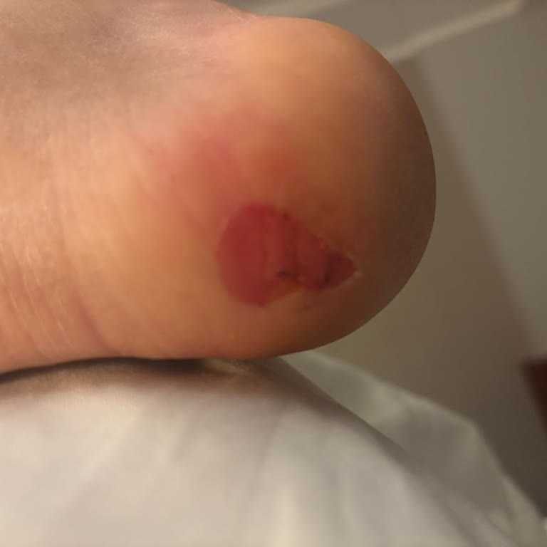 Aynı Üründe Farklı İade Kararı Ve Sağlık Sorunu