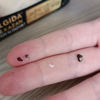 Dondurmadan Çıkan Cam Parçası İle Yaşadığım Büyük Tehlike